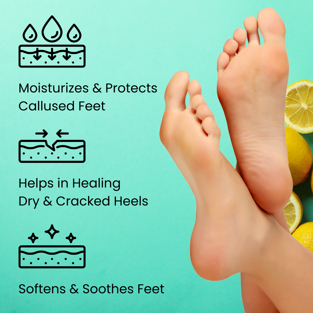 Dry Heels? This Simple Lemon Hack Will Fix Them Fast | Fun to be one, Cracked  heels, Cracked heel remedies